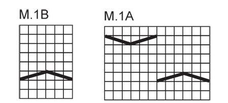 modello di una treccia con un'ombra di aghi un diagramma con una descrizione 