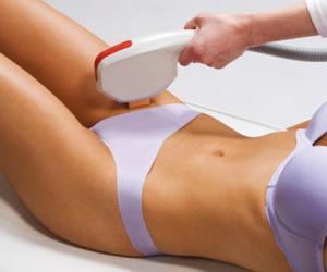 Epilazione laser della zona bikini