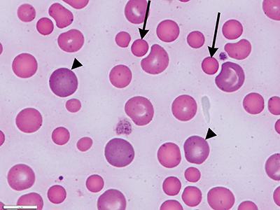 anisocitosi bassa di erythrocytes 