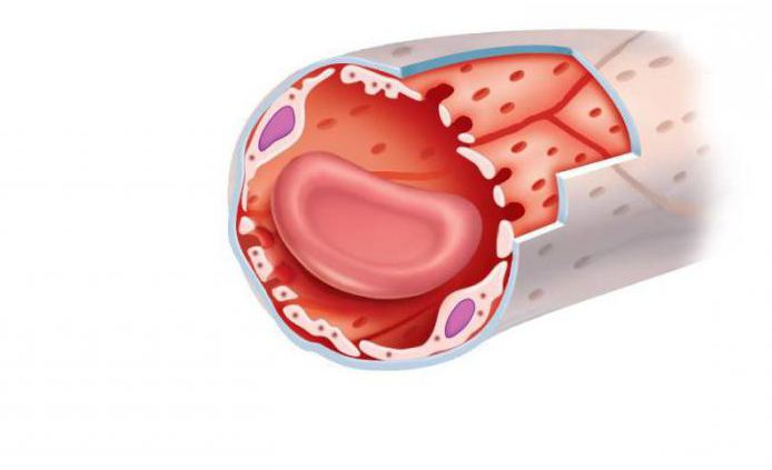 Ciò che distingue le arterie dalle vene: le caratteristiche della struttura e il funzionamento