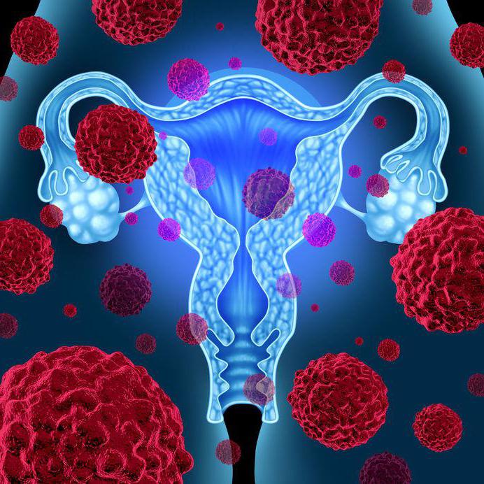 trattamento della displasia cervicale di 3 gradi