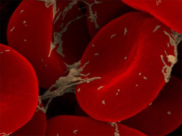 I leucociti nel sangue sono normali