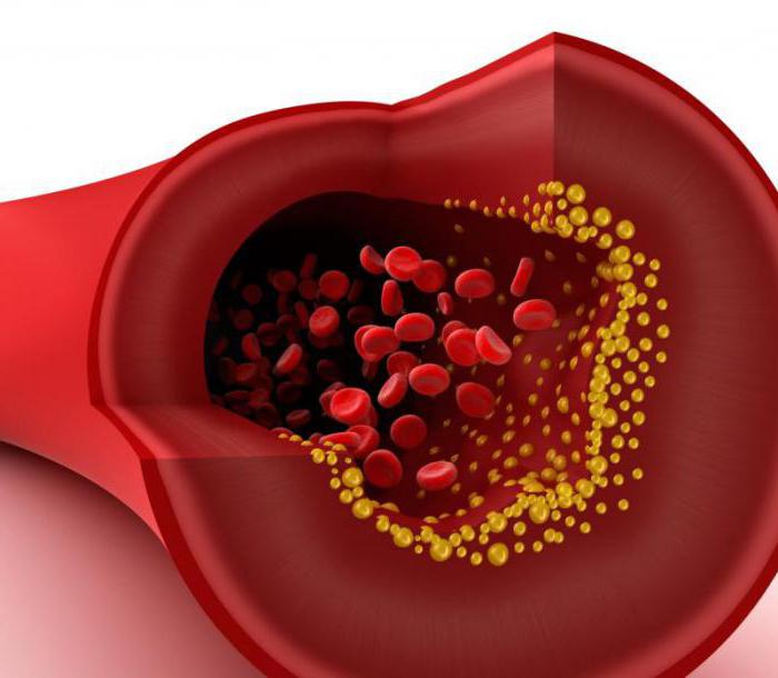 strati di parete arteriosa