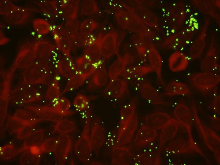 ureaplasmosis nelle donne e negli uomini 