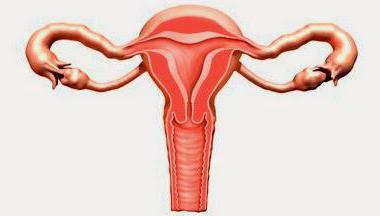 sintomi di infiammazione ovarica e trattamento nelle donne