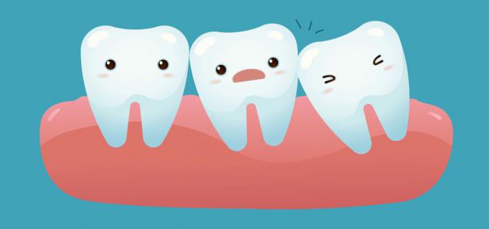 Devo rimuovere il dente del giudizio e perché? 