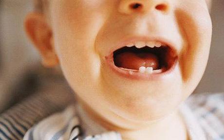 Denti in un bambino fino a un anno: cosa cercare genitori premurosi